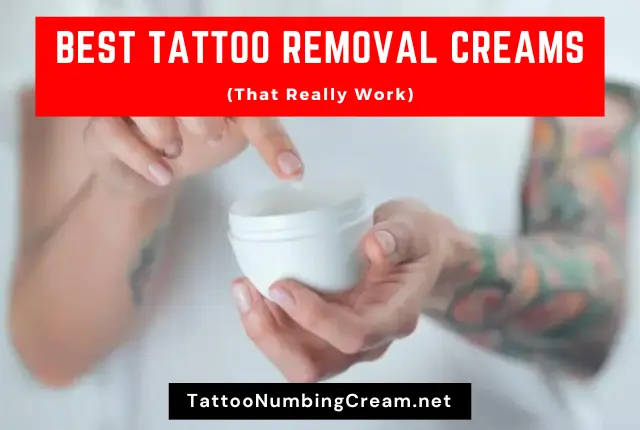Best Tattoo Removal Creams (That Really Work)