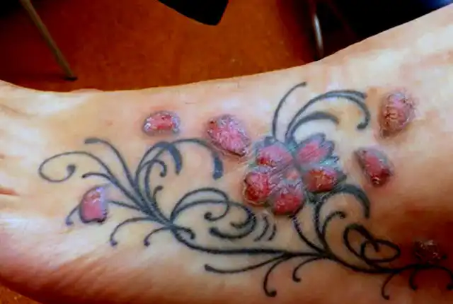 How To Prevent Tattoo Infection