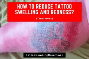 How To Reduce Tattoo Swelling And Redness (Treatment)
