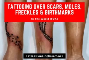 Tattooing Over Scars, Moles, Freckles & Birthmarks (Guide)
