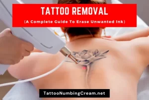 Tattoo Removal Guide To Erase Unwanted Ink